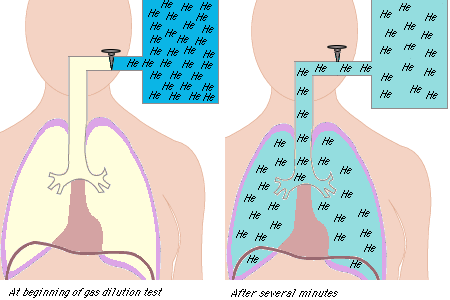 什么是气体陷闭难！温故未必能知新——肺通气_https://www.jmylbn.com_新闻资讯_第19张