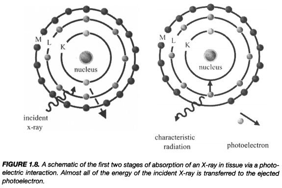 x线为什么锥形束医学影像学 ｜ X线成像_https://www.jmylbn.com_新闻资讯_第6张