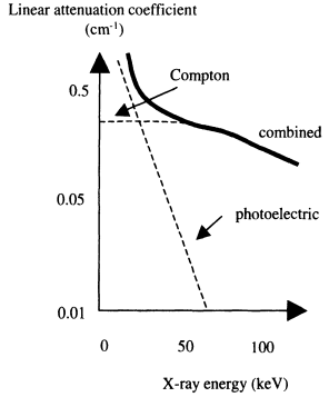 x线为什么锥形束医学影像学 ｜ X线成像_https://www.jmylbn.com_新闻资讯_第8张