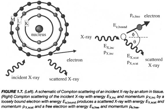 x线为什么锥形束医学影像学 ｜ X线成像_https://www.jmylbn.com_新闻资讯_第4张