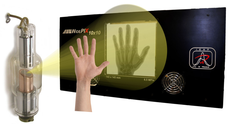 x线为什么锥形束医学影像学 ｜ X线成像_https://www.jmylbn.com_新闻资讯_第1张