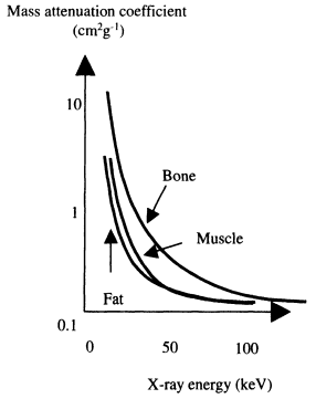 x线为什么锥形束医学影像学 ｜ X线成像_https://www.jmylbn.com_新闻资讯_第9张