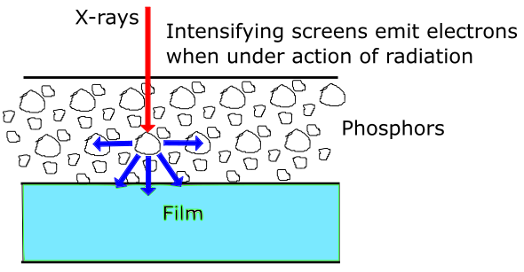 x线为什么锥形束医学影像学 ｜ X线成像_https://www.jmylbn.com_新闻资讯_第17张
