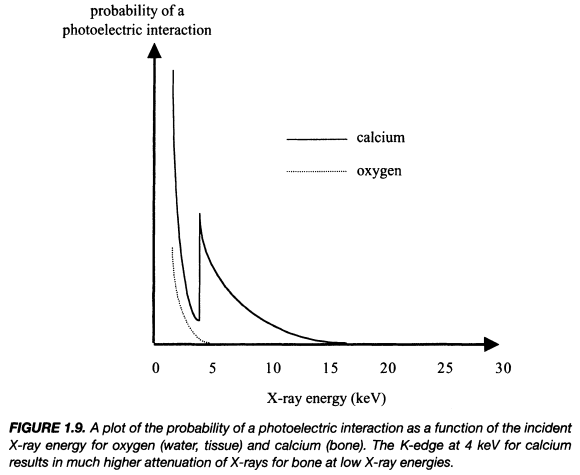 x线为什么锥形束医学影像学 ｜ X线成像_https://www.jmylbn.com_新闻资讯_第7张