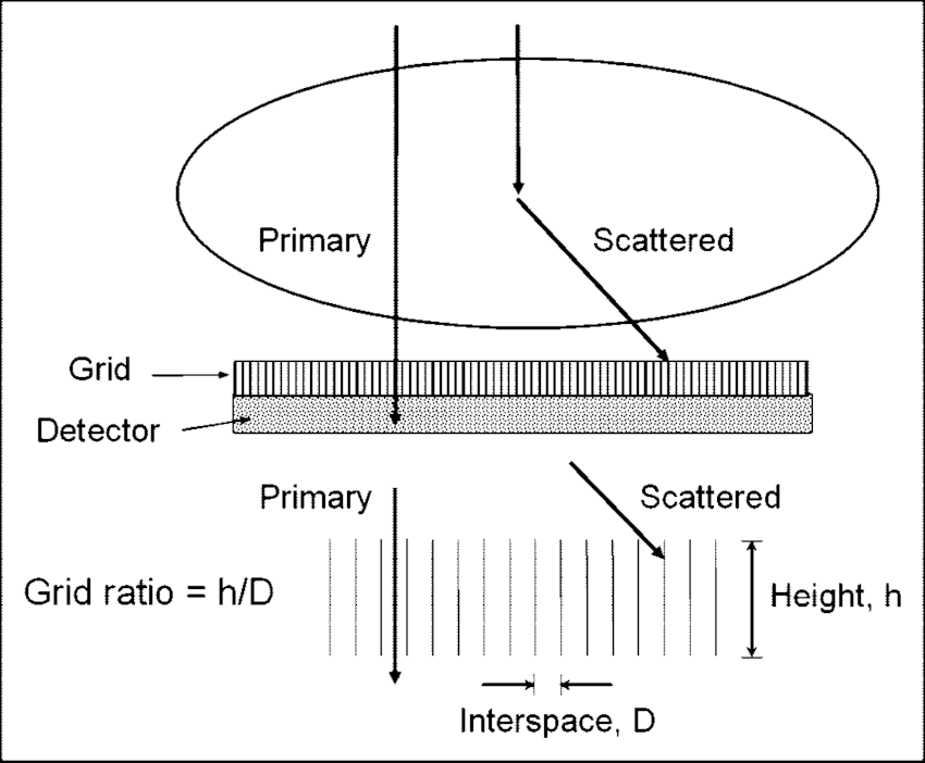 x线为什么锥形束医学影像学 ｜ X线成像_https://www.jmylbn.com_新闻资讯_第16张
