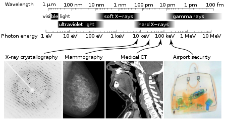 x线为什么锥形束医学影像学 ｜ X线成像_https://www.jmylbn.com_新闻资讯_第2张