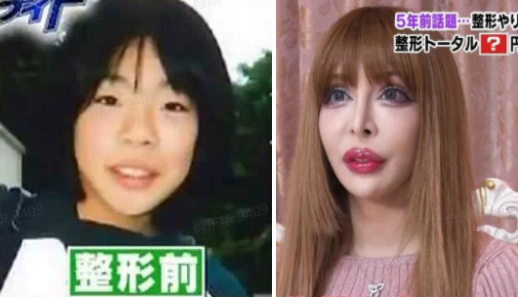 5岁被嘲“最丑星二代”，10岁近照逆袭“人间腿精”吓傻网友：黄多多，你输了（组图） - 31