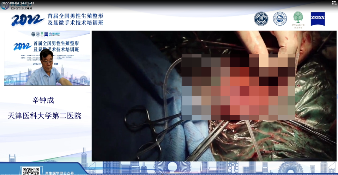 整形手术器械有什么2022首届全国男性生殖整形及显微手术技术培训班圆满收官_https://www.jmylbn.com_新闻资讯_第26张