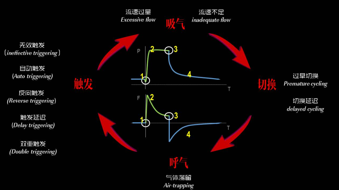 为什么呼吸机人机同步【涨知识】呼吸机人机不同步识别和处理_https://www.jmylbn.com_新闻资讯_第7张