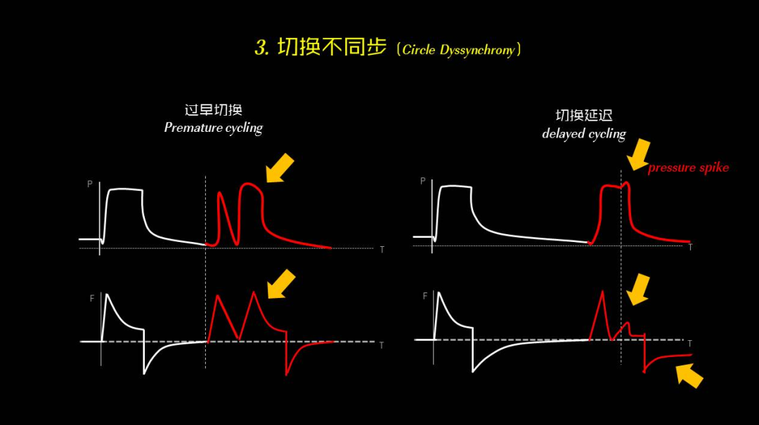 为什么呼吸机人机同步【涨知识】呼吸机人机不同步识别和处理_https://www.jmylbn.com_新闻资讯_第5张