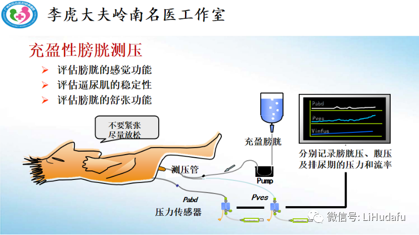 Q A 尿流动力学的问与答 前列腺增生 好大夫在线