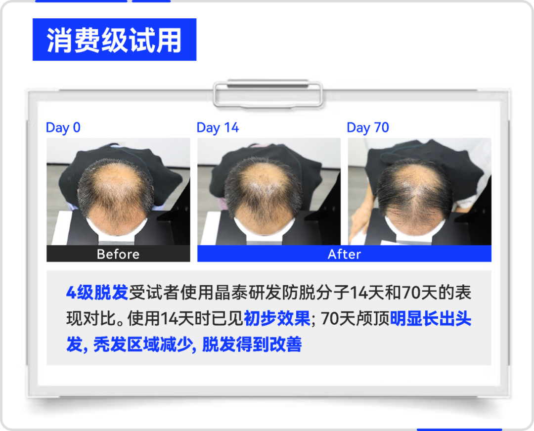 晶泰科技AI破局生发难题，“双子星”新分子联用引领突破性效果