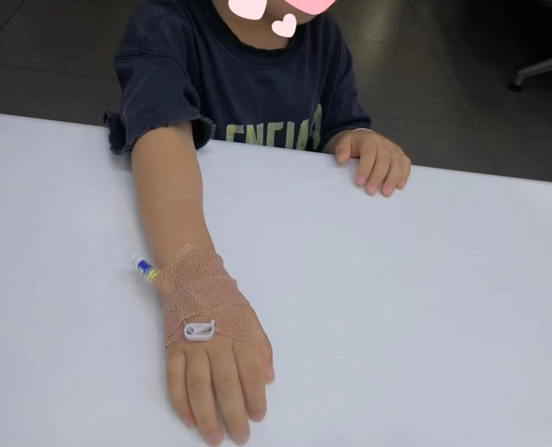 为什么要用留直针【科普】为什么孩子连着几天“挂瓶”，得用“静脉留置针”（“软针”）？_https://www.jmylbn.com_新闻资讯_第1张