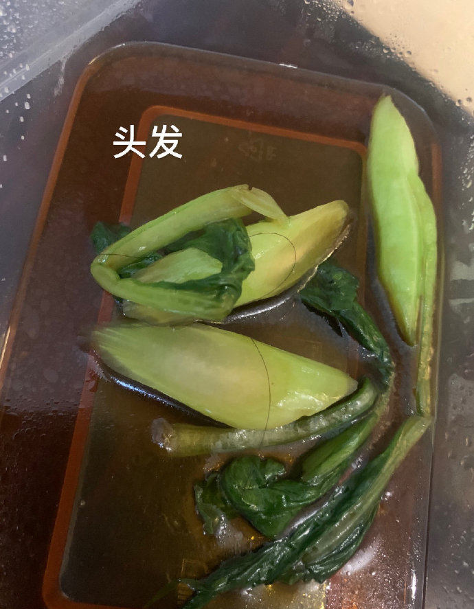 47位留学生回国隔离结果集体腹泻！酒店却说：水土不服（组图） - 7