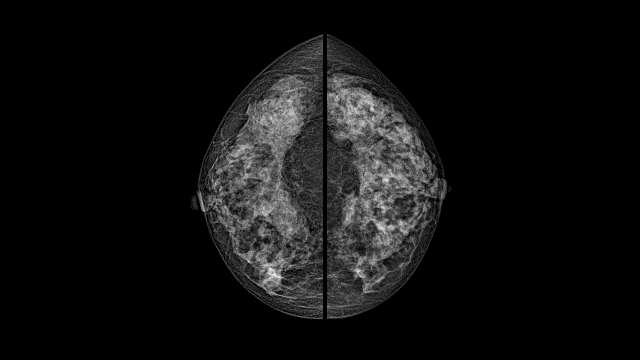 乳腺dr能检查什么盘州市第二人民医院引进国内一流乳腺DR机_https://www.jmylbn.com_新闻资讯_第7张