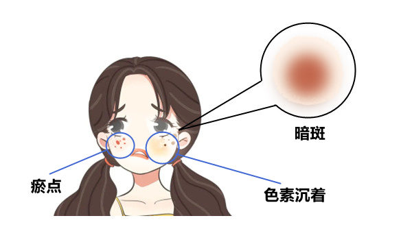医用消疤贴怎么用大白话说中医第五百八十四期｜秦艽加上白僵蚕，祛斑消疤不麻烦_https://www.jmylbn.com_新闻资讯_第24张