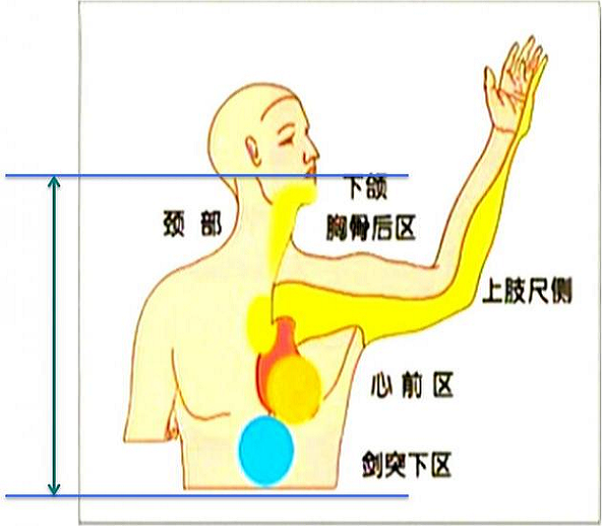 手动心电图怎么拉明明是拉肚子，为什么让我做心电图？_https://www.jmylbn.com_新闻资讯_第4张