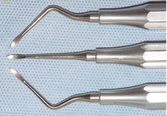 注意牙挺拔牙的技巧，千万别踩雷！