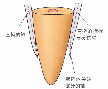 注意牙挺拔牙的技巧，千万别踩雷！