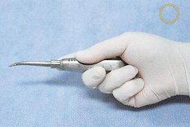 注意牙挺拔牙的技巧，千万别踩雷！