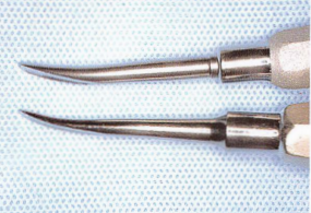 注意牙挺拔牙的技巧，千万别踩雷！