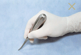 注意牙挺拔牙的技巧，千万别踩雷！