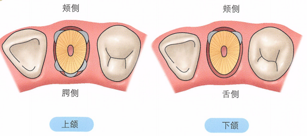 注意牙挺拔牙的技巧，千万别踩雷！