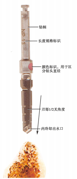 口腔器械盒怎么用种植器盒器械工具详解，建议收藏！（1）余见今日次条_https://www.jmylbn.com_新闻资讯_第8张