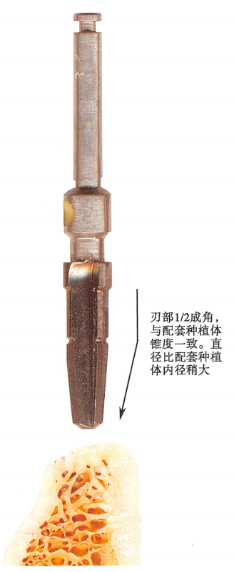 口腔器械盒怎么用种植器盒器械工具详解，建议收藏！（1）余见今日次条_https://www.jmylbn.com_新闻资讯_第11张