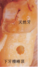 口腔器械盒怎么用种植器盒器械工具详解，建议收藏！（1）余见今日次条_https://www.jmylbn.com_新闻资讯_第3张