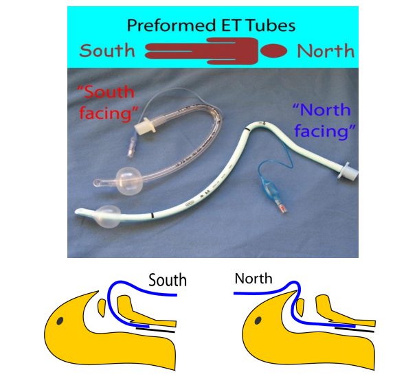 医用气管有哪些实用技术丨常规气管导管的7个结构细节&6种特殊类型的气管导管_https://www.jmylbn.com_新闻资讯_第14张