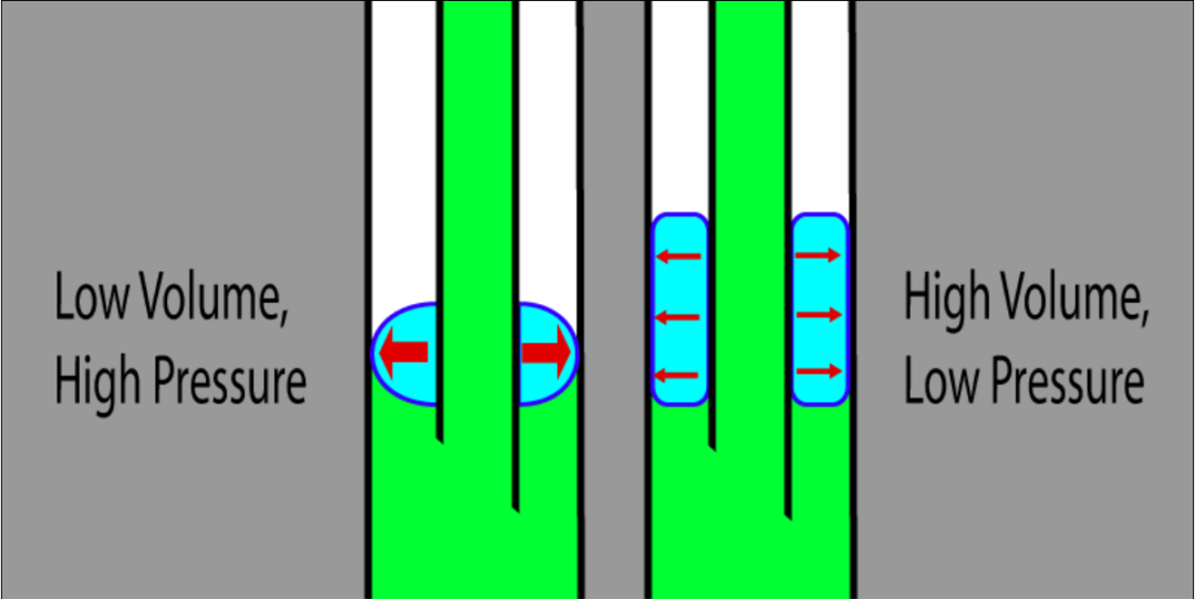 医用气管有哪些实用技术丨常规气管导管的7个结构细节&6种特殊类型的气管导管_https://www.jmylbn.com_新闻资讯_第10张