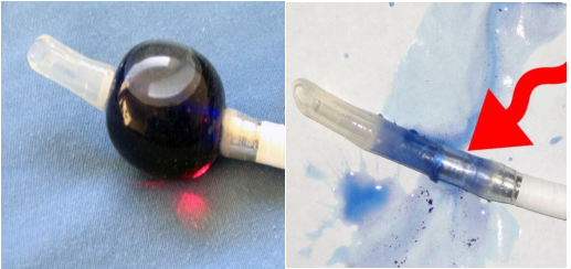 医用气管有哪些实用技术丨常规气管导管的7个结构细节&6种特殊类型的气管导管_https://www.jmylbn.com_新闻资讯_第18张