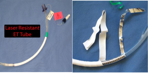 医用气管有哪些实用技术丨常规气管导管的7个结构细节&6种特殊类型的气管导管_https://www.jmylbn.com_新闻资讯_第17张