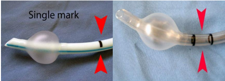 医用气管有哪些实用技术丨常规气管导管的7个结构细节&6种特殊类型的气管导管_https://www.jmylbn.com_新闻资讯_第8张