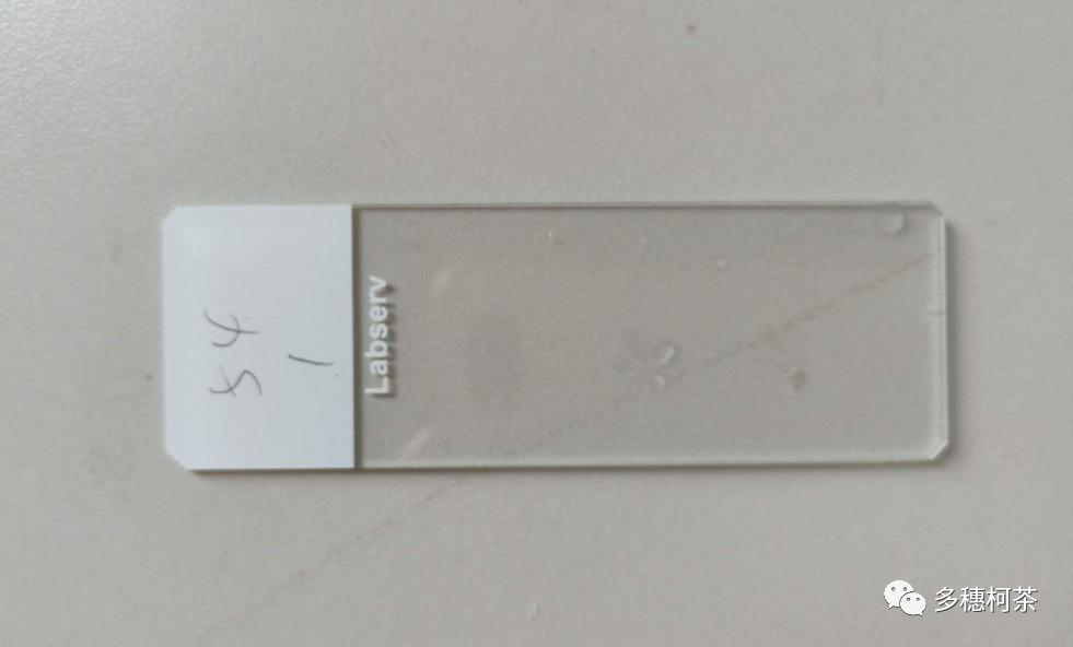 什么是病理蜡块癌症治疗中的白片、切片、染色片、蜡块是什么？看完这个，癌症治疗路上不折腾！_https://www.jmylbn.com_新闻资讯_第6张