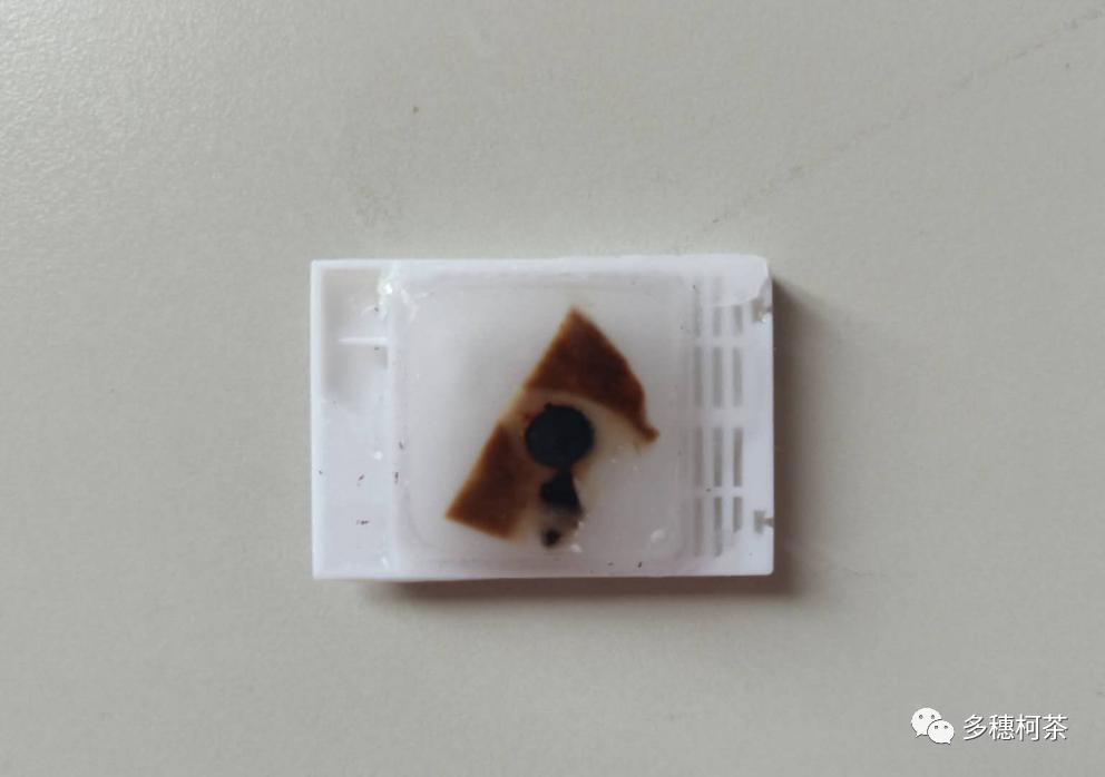 什么是病理蜡块癌症治疗中的白片、切片、染色片、蜡块是什么？看完这个，癌症治疗路上不折腾！_https://www.jmylbn.com_新闻资讯_第5张