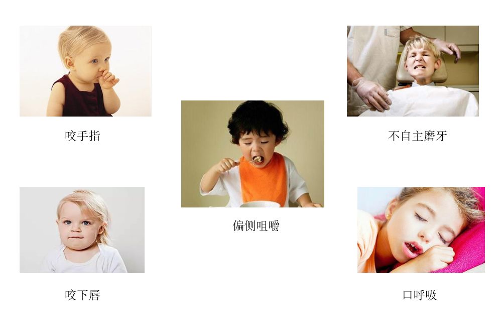 每3个孩子就有2个牙齿不齐，你的孩子中招了吗？