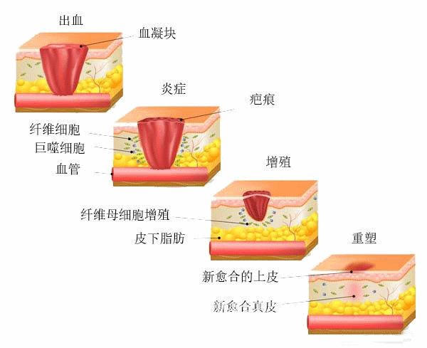 壳聚糖凝胶效果怎么样都在问的“擦伤／划伤／摔伤用什么不留疤”？答案来了_https://www.jmylbn.com_新闻资讯_第6张