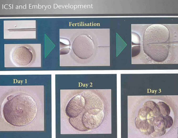 有哪些精子问题做试管也解决不了?