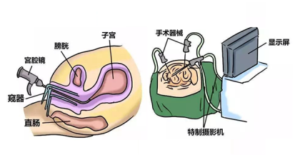 月经过多过少，也许是不孕的警告！