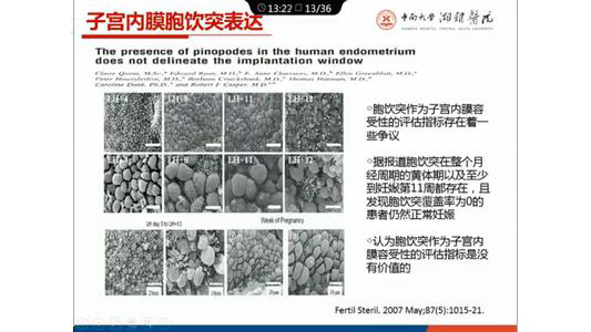 「试管知识篇」试管婴儿要成功，别让子宫内膜影响了成功率！