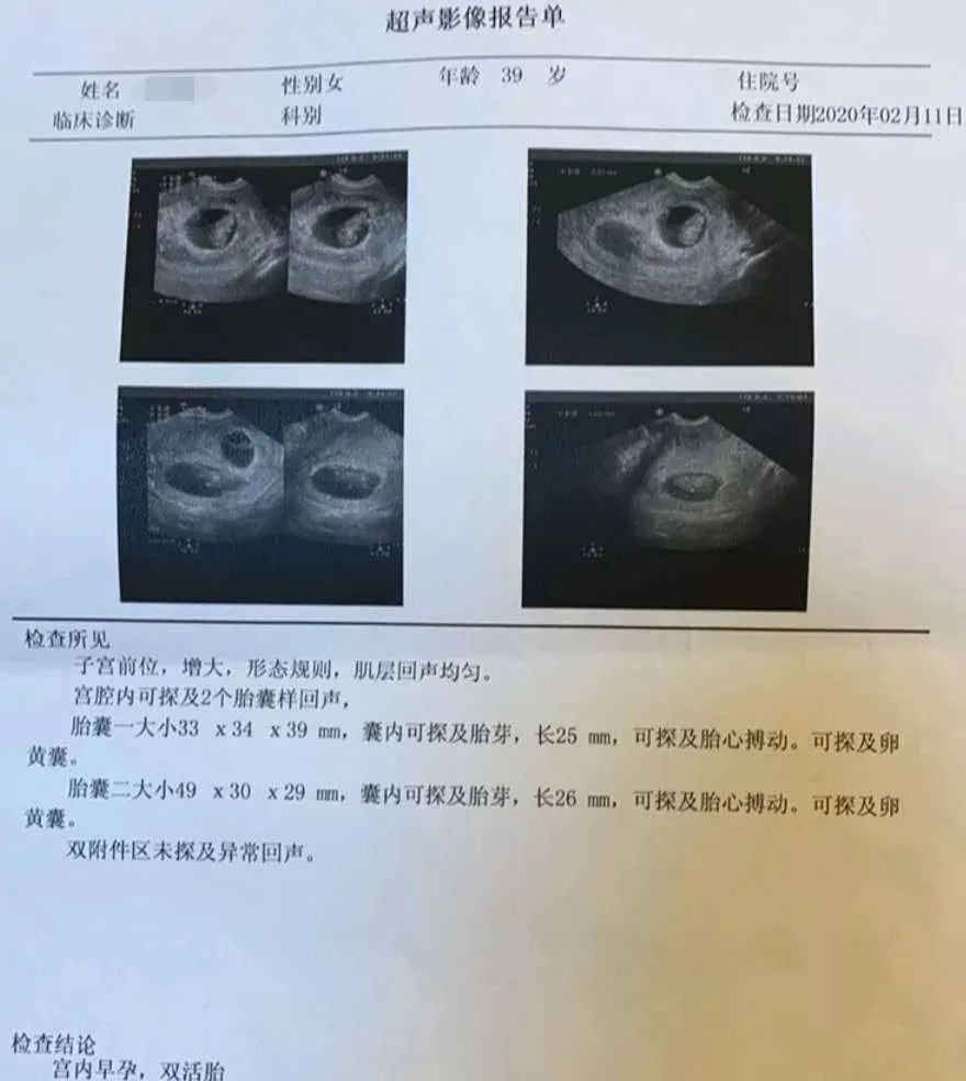 好孕百科  |  不要小看引发不孕的子宫“多肉”