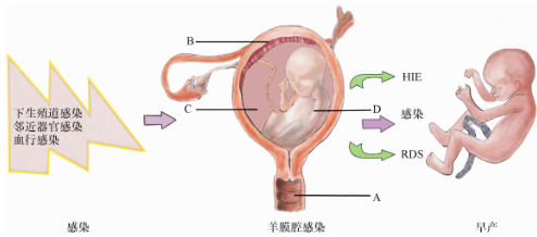 孕期这些坑危害大，90%的姐妹却不知道！
