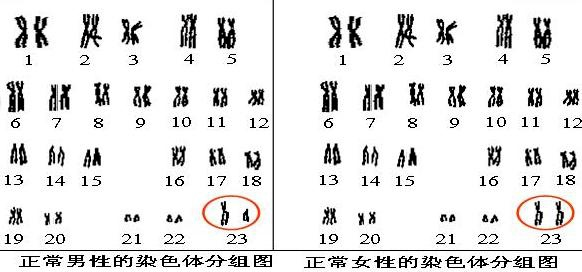 胎儿的染色体还会自己变异常?蚌埠住了！