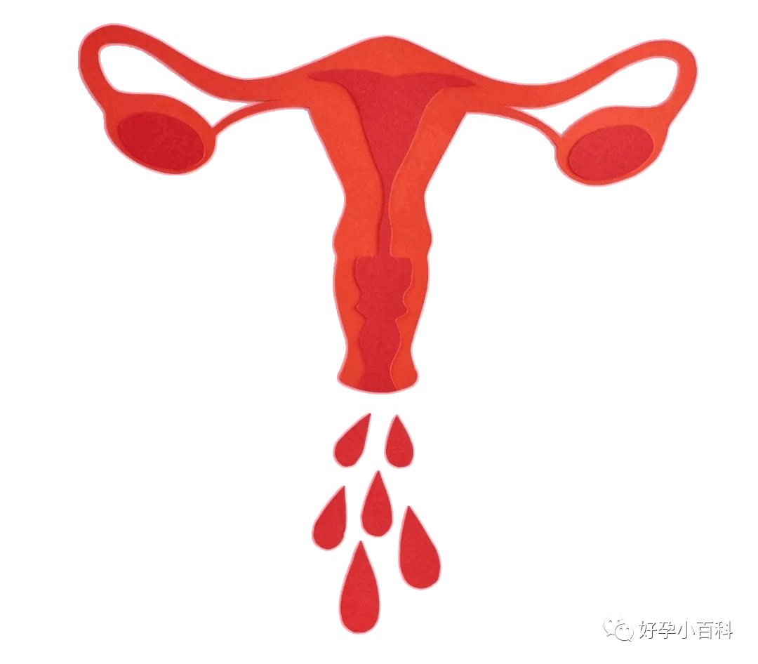 月经不调，量少发黑怎么办？是卵巢早衰了？