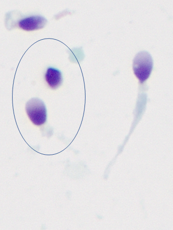 别瞎造了！精子存活率低也会影响试管成功率