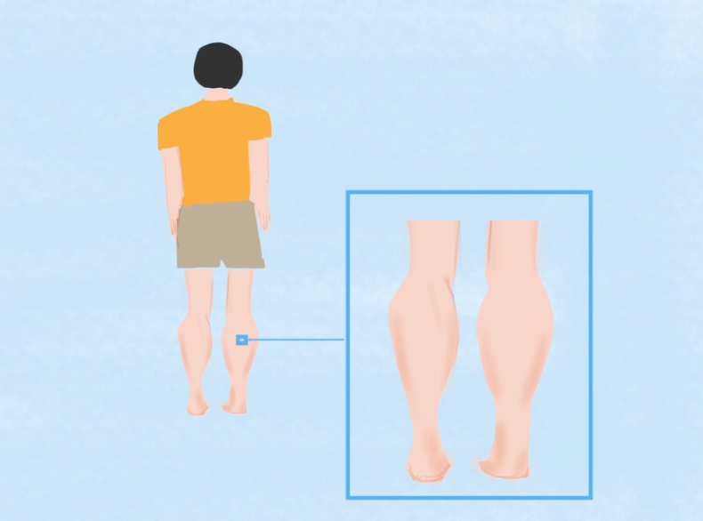 发病率高、无法治愈......这种“传男不传女”的遗传病居然是真的！