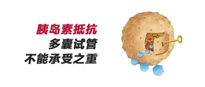 多囊卵巢试管，为什么要检查【胰岛素抵抗】?