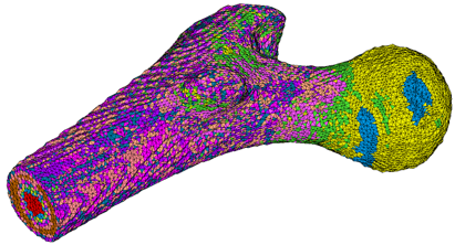 设计仿真 | 直播预告-Marc 仿真助力医学医疗研发创新的图1